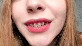 Cum on my braces !