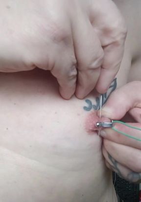 Two acupuncture needles passing through my nipple
