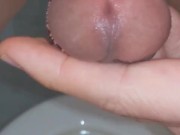 Observation of my urethral opening