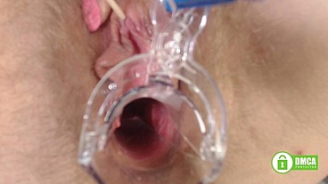 Gainful gyno exam - opening hairy pussy with speculum