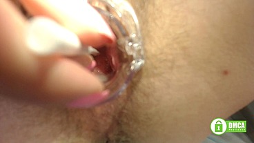 Gainful gyno exam - opening hairy pussy with speculum