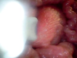 Endoscope camera shows the nearly any sensitive parts of the jock Educational clip