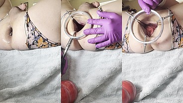 Reneenicolecd - update #92 - Huge 12 cm Anal Stretcher with Power Tools - Aug 18, 2026