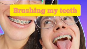 Me cepillo los dientes y muestro mis dientes y brackets