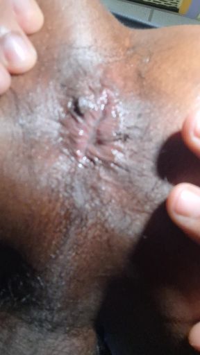 Start prolapse training Indian Boy