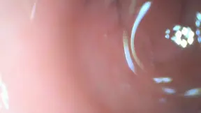 She gets her tight ass stretched by an endoscope