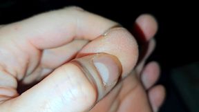 CLOSE UP: Pedicure Inspection Nail Scratching