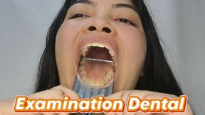 Examination Dental: Yellow teeth, cavities