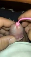Mini egg sounding in peehole