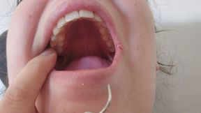 Extreme Dental Close-Up – Showing My Cavities with Dentist Tools!