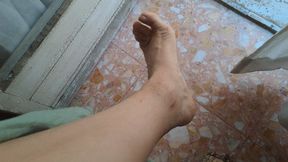 PAINFUL BLISTERS AND DIRTY SOLES