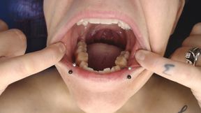Closeup Inside Mouth Compilation