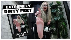 Extremely dirty feet & SPH