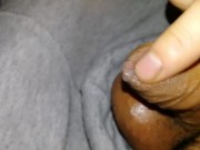 Uncut micropenis oozing precum and gets jerked until thick gooey cum splurts! sorry for shaky cam!