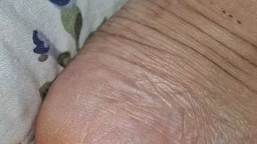 Marks on the legs