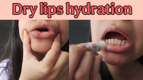 Teasing and pulling my dry cracked lips before putting on lip balm