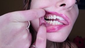 WORSHIP MY PERFECT TEETH