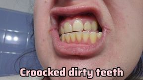 Dirty Yellow Teeth After a Whole Month Without Brushing – I Show My Rotting Smile Before Scrubbing the Pain Away (Cavities + Sensitivity Fetish)
