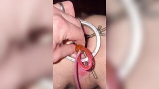 Homo butt dilator
