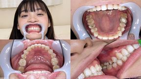 Urara - Watching Inside mouth of Japanese cute girl bite-264-1 - MOV 1080p