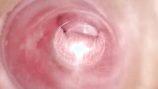 Having Fun with clear plug cervix watch