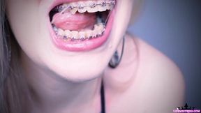 Pink Braces Obsession! - 21 years old - JOI - Young domme - brat girls - femdom - teeth fetish - mouth fetish