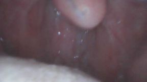 Bailey's Mouth ENDOSCOPE FOOTAGE