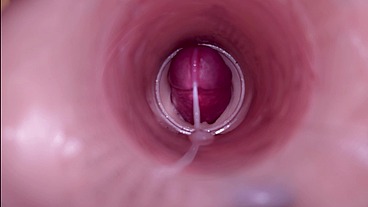 Female Insemination - Internal Camera Captures Deep Male Ejaculation