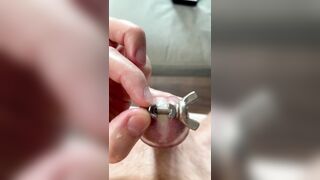 Urethral ejaculation