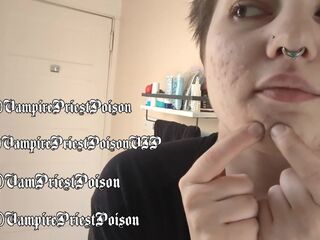 PREVIEW Zit Popping Episode three