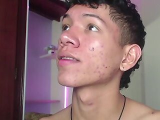 BEAUTIFUL teen cam boy with cute braces and acne