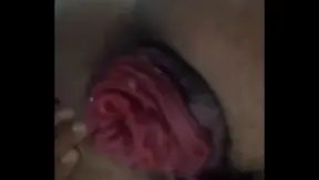 Extreme Anal Prolapse – Intense Gay Sex Pushing Limits