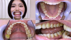 Inori Mano - Watching Inside mouth of Japanese cute girl - 1080p