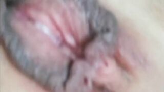 French huge snatch lips