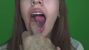 Finger bitting?