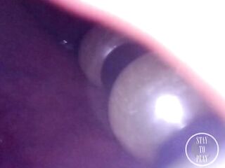 LIVECAM INSIDE BUTT: The Balls disappeared unfathomable inside my aperture ⚽⛓ - Preview