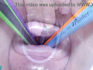 Sexy Lesbian babes get prolapse cervix with catheters inserted into their uterus