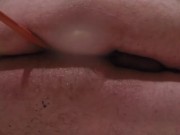 Retention Enema and Release 03