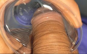 Mysterious Solution Inserted Into the Wrinkled Cock.