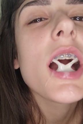 Cum on butterfly braces