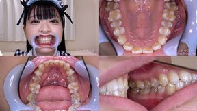 Anna Hanayagi - Watching Inside mouth of Japanese cute girl - 1080p