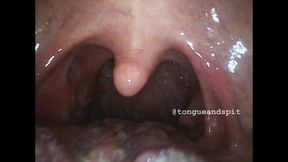 William Mouth Endoscope Part19 Video1 NO AUDIO - WMV