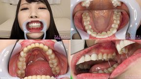 Kurumi - Watching Inside mouth of Japanese cute girl bite-193-1 - wmv 1080p