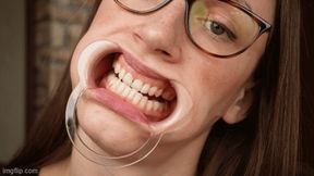 Mouth exploration