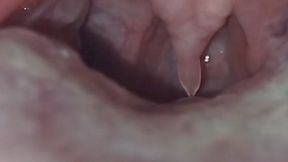 Franchesca's uvula