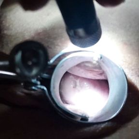 Speculum play in my pussy