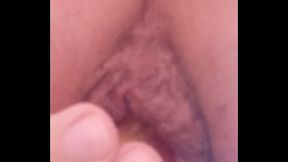 I irritating my hemorrhoidal rose to the point of gigantic prolapse