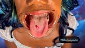 Dental retractor, drool Tongue video