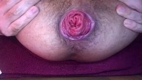 Cuz&atilde_o Arrombado (Rosebud   Dildo)
