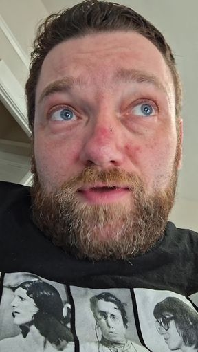 Crutches cub fingering my beefy hole